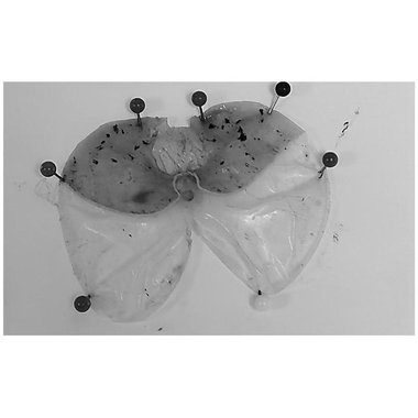 维宁 硫糖铝颗粒 1克×12袋 新乡市常乐制药有限责任公司