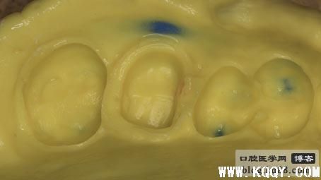 君安生物 藻酸双酯钠片