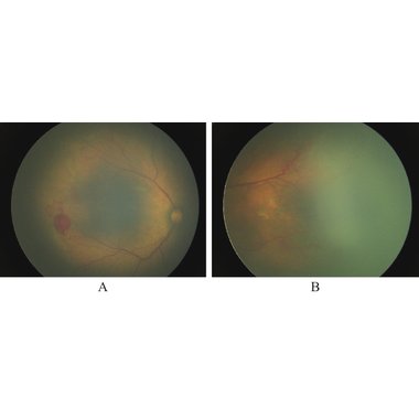 注射剂 血塞通注射液
