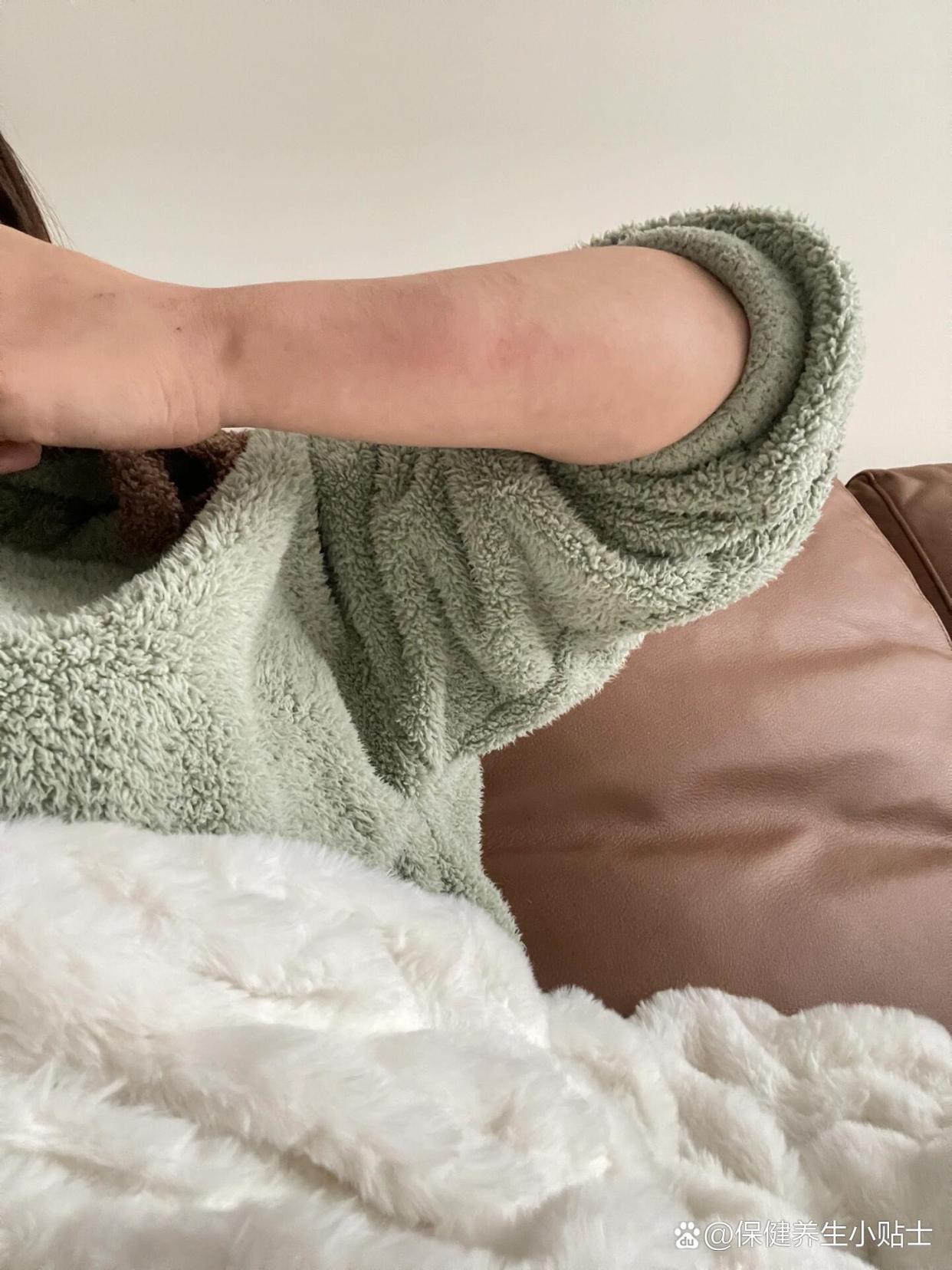 注射剂 注射用七叶皂苷钠