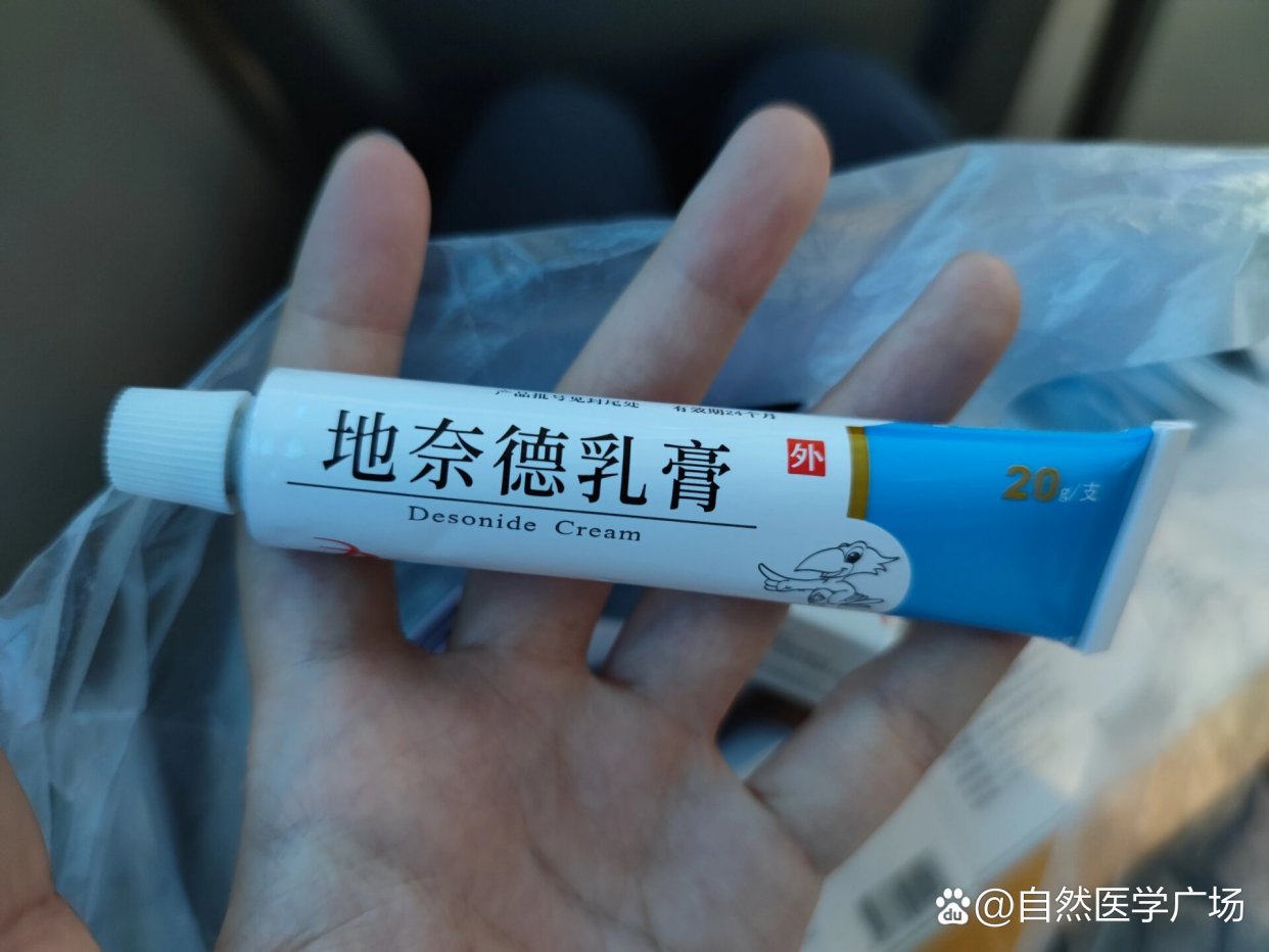 力言卓 地奈德乳膏