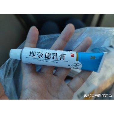 力言卓 地奈德乳膏