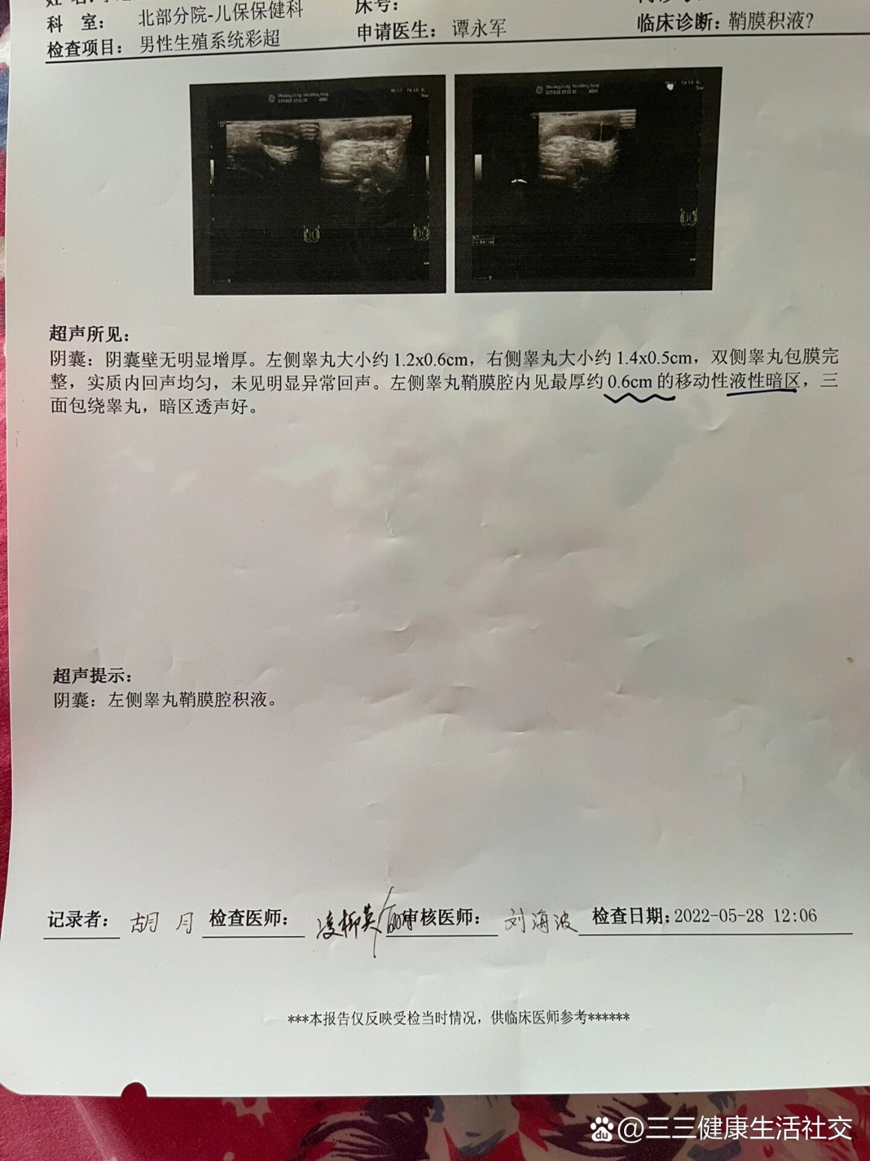 江西泽众 睾丸片