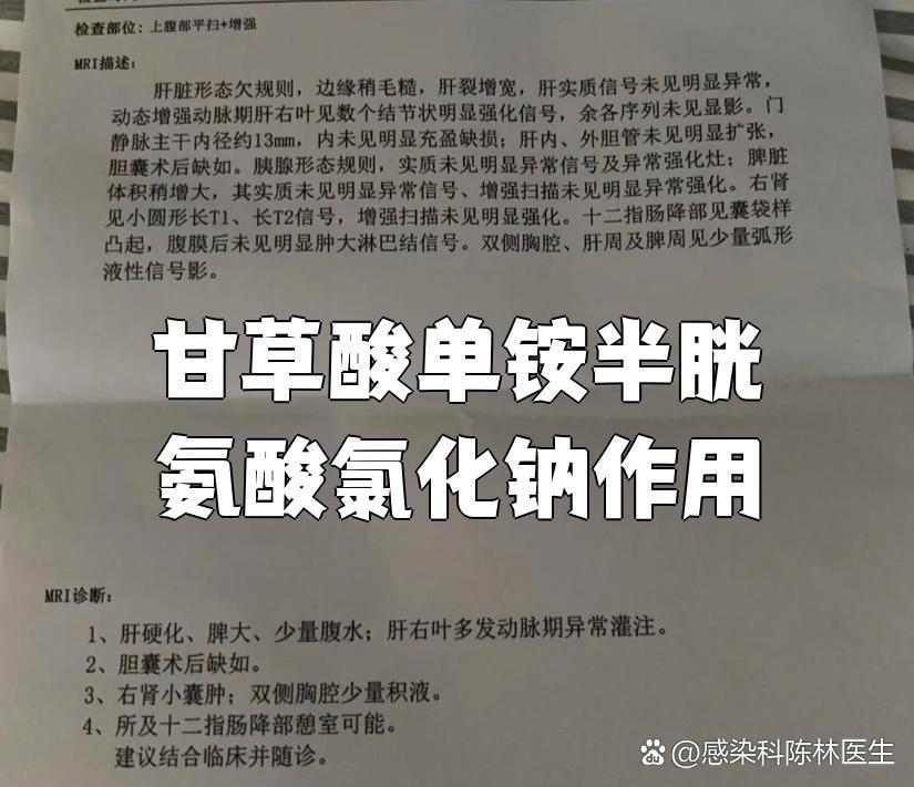 多多 复方甘草酸单铵注射液