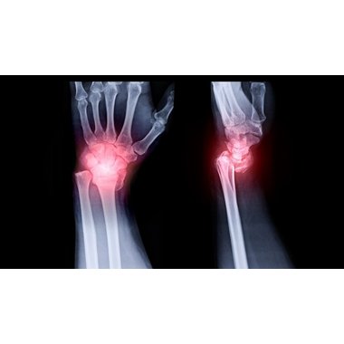 康缘 复方南星止痛膏 10cm*13cm*5贴 江苏南星药业有限责任公司