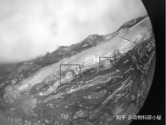 苏肽生 注射用鼠神经生长因子 周围神经病