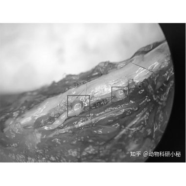 苏肽生 注射用鼠神经生长因子 周围神经病