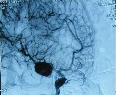 未名 注射用鼠神经生长因子