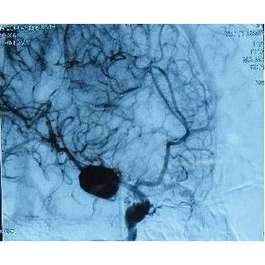 未名 注射用鼠神经生长因子