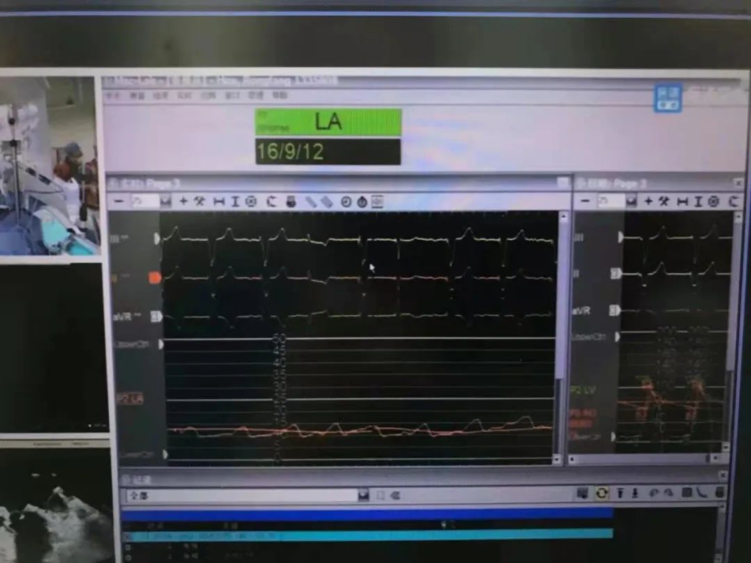优选 华法林钠片(套盒