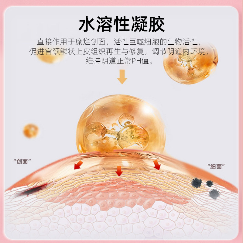 优选 卡波姆阴道阻菌凝