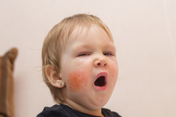 优选 盐酸左西替利嗪口