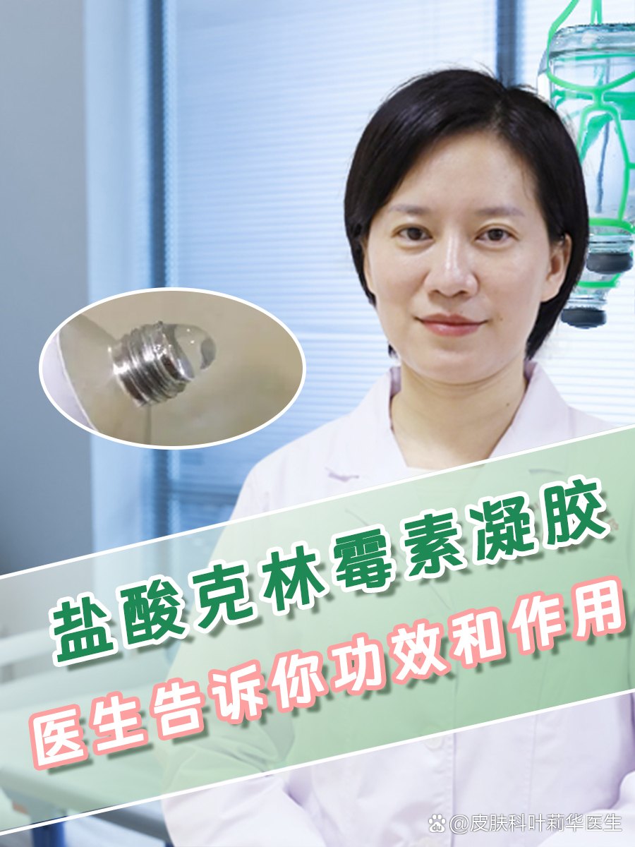 优选 盐酸克林霉素凝胶