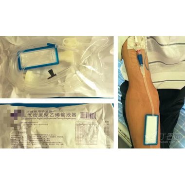 一次性使用输液器