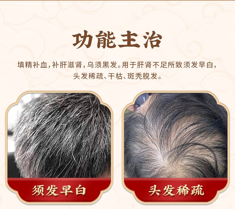 优选 固肾生发丸