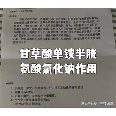 复方甘草浙贝氯化