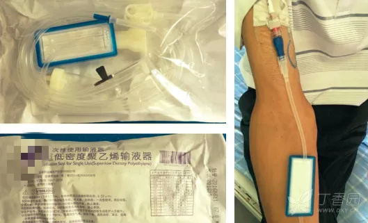 优选 一次性使用输液器