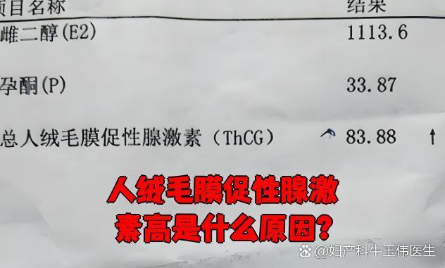 优选 人绒毛膜促性腺激