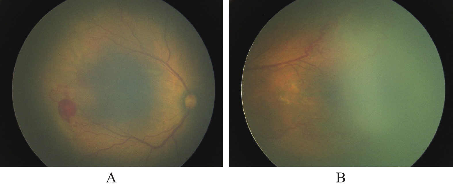 优选 血塞通注射液