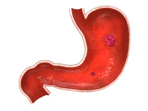 优选 拉呋替丁颗粒