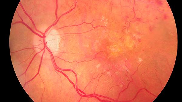 优选 普罗布考片