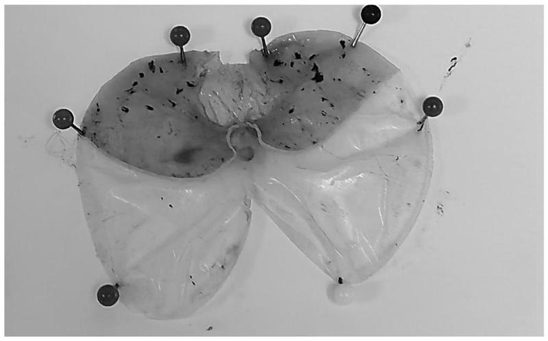 优选 硫糖铝咀嚼片