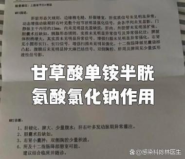 优选 甘草酸二铵胶囊