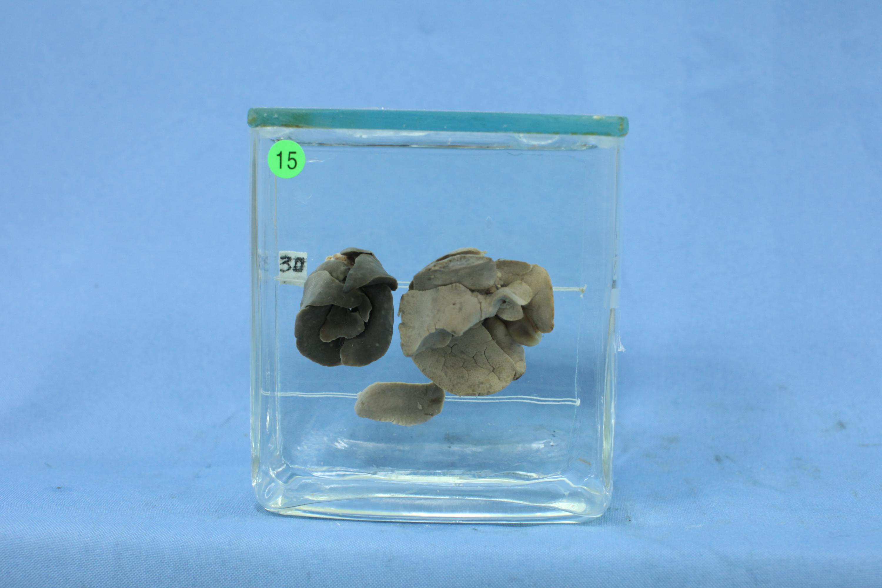 优选 异烟肼注射液