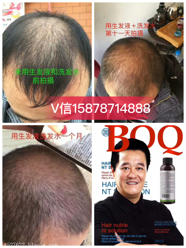 优选 七宝美髯丸